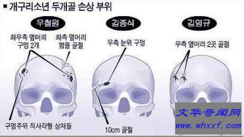 青蛙少年失踪案